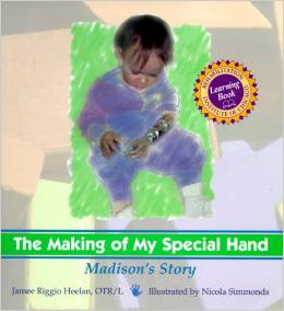 Dysmelie The Making of my Spedial hand.png